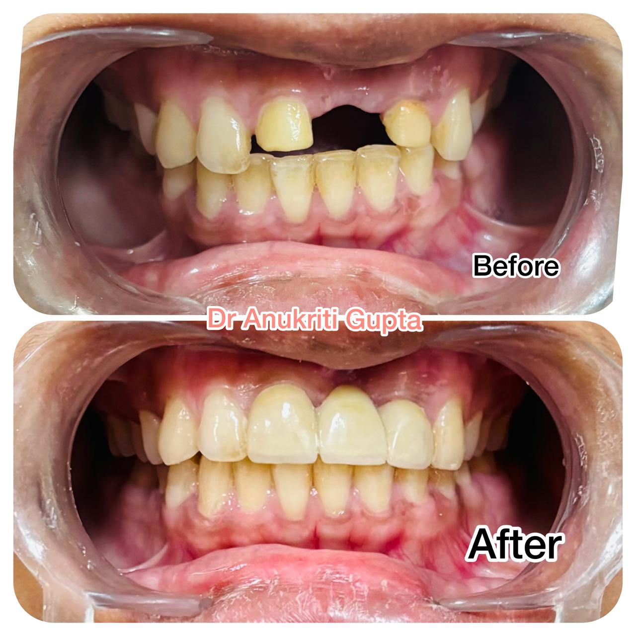 Pregnancy dental care