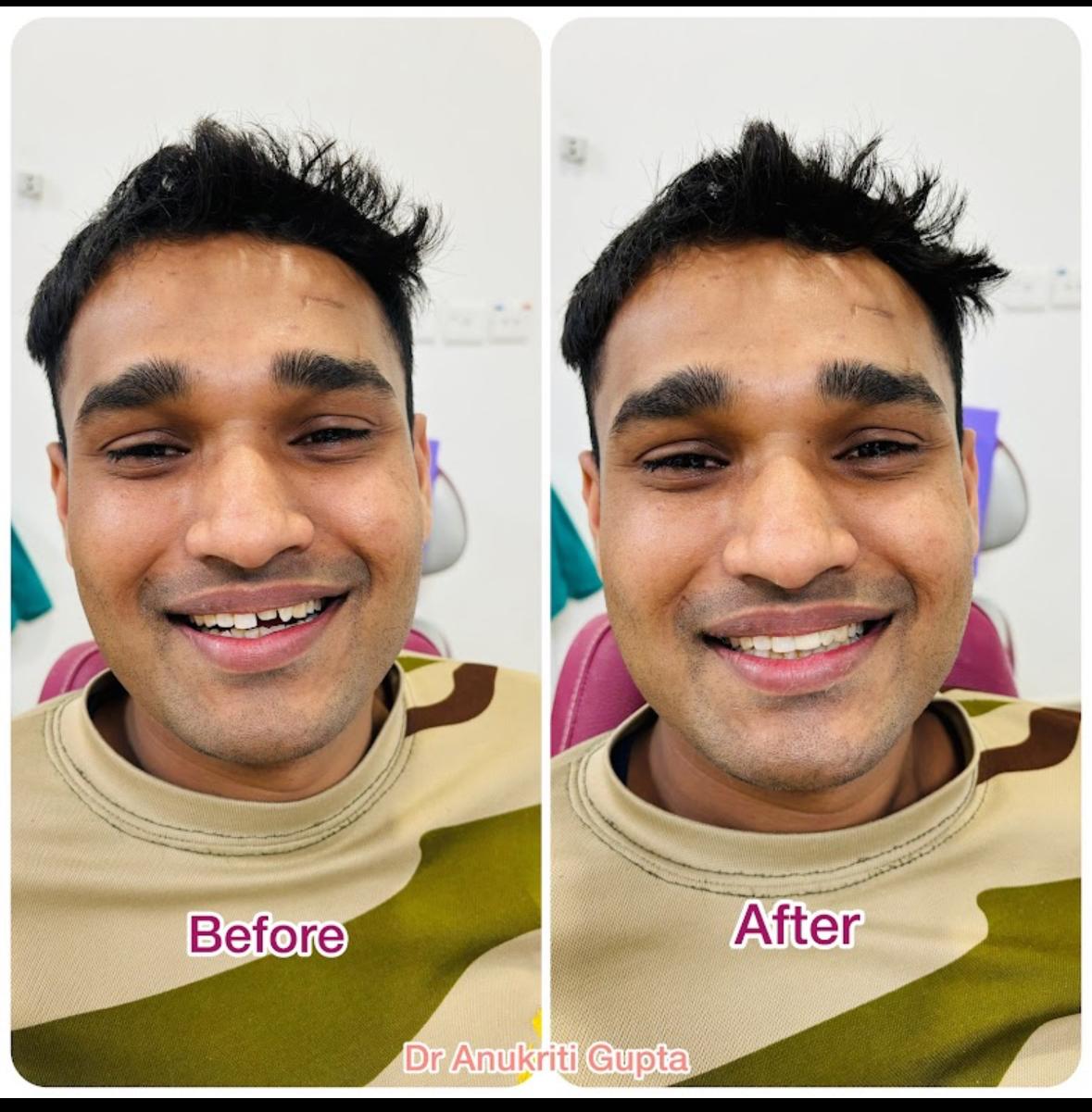 Pregnancy dental care