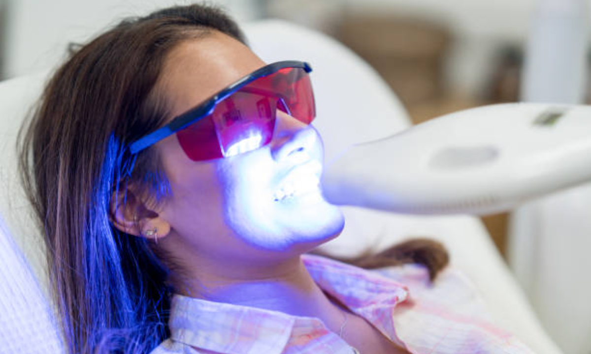Top Benefits of Professional Teeth Whitening You Should Know